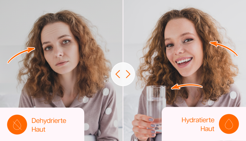 Grafik, die den Effekt dehydrierter Haut darstellt