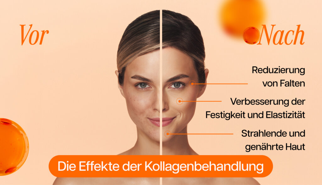Grafik, die die Ergebnisse der Kollagenbehandlung darstellt