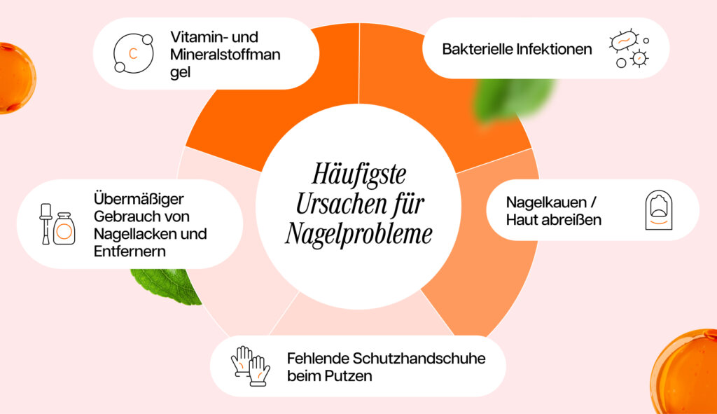 Infografik zu den häufigsten Ursachen für Nagelprobleme