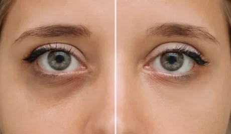 Hautschutz bei der Arbeit am Computer