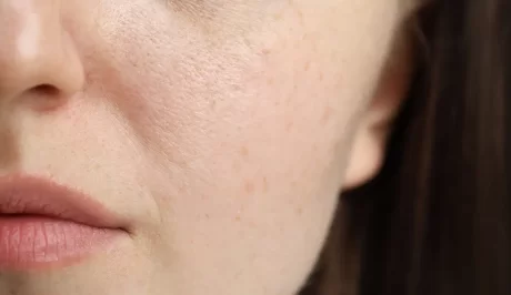 Warum altert die Haut in der Stadt schneller?